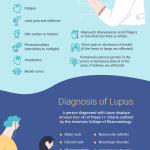How Do You Diagnose Lupus